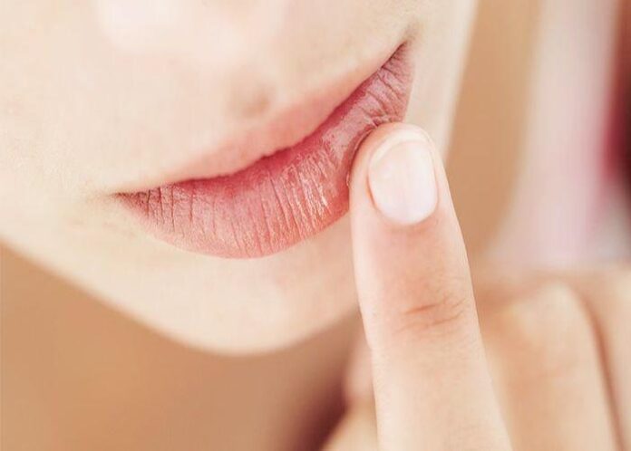 LIP CARE | ತುಟಿಗಳು ಒಡೆದು ರಕ್ತ ಬರುತ್ತಿದೆಯೇ? ಮೃದುವಾದ ತುಟಿಗಳಿಗಾಗಿ ಹೀಗೆ ಮಾಡಿ..